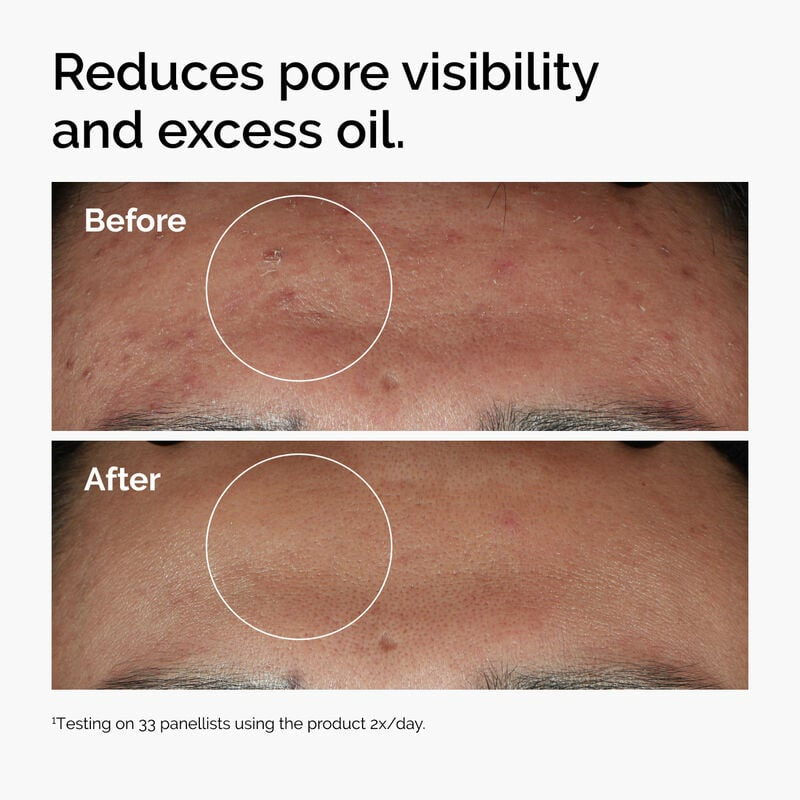The Ordinary Niacinamide 10% + Zinc1%