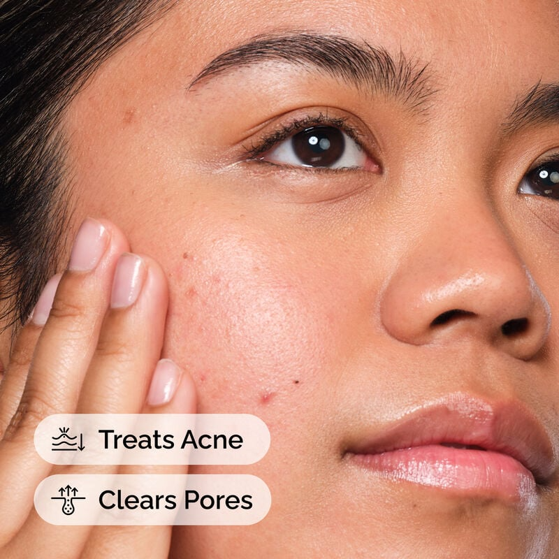 The Ordinary Salicyclic Acid 2% Solution